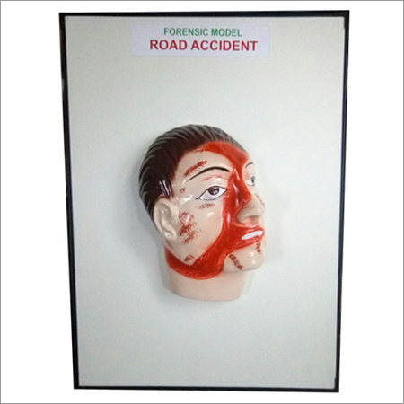 Road Accident