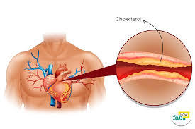 Anti Cholesterol Medicine