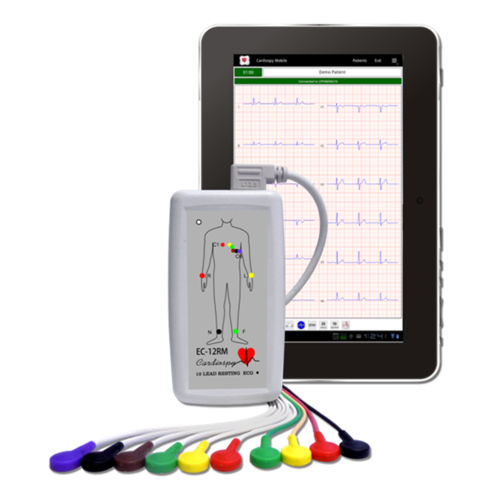 12 Channel Mobile Electrocardiograph