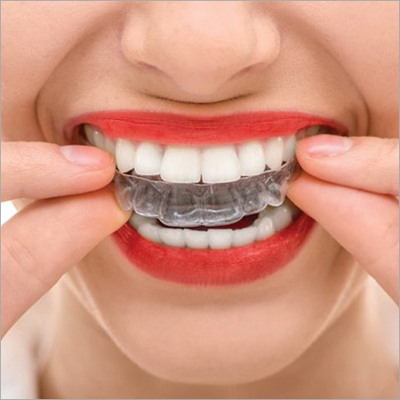 Veristic Aligners
