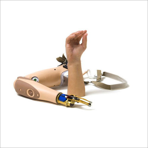Myoelectric Prosthetics Hand