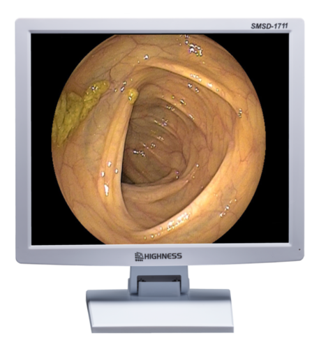 Medical Grade Surgical LCD Monitor Displays