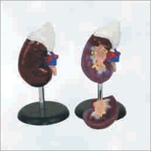 Pvc Human Kidney With Adrenal Gland