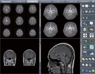 MRI Work Station