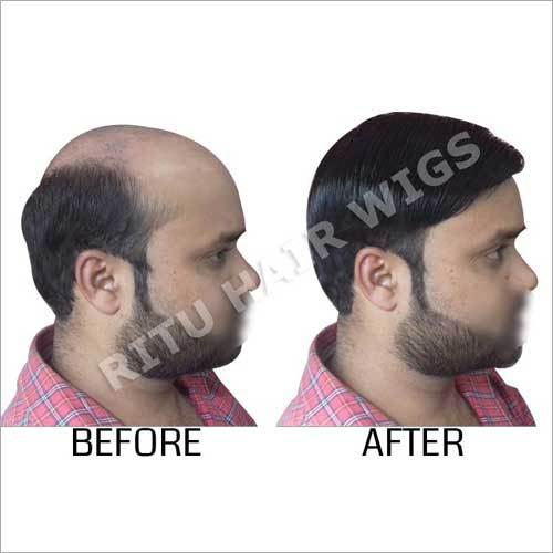 Hair Wigs