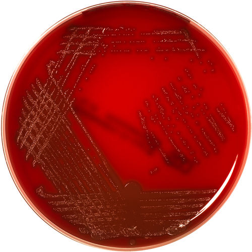 Columbia Agar Plate (Sheep blood 5%)