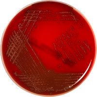 Columbia Agar Plate (Sheep blood 5%)