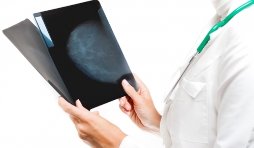 2D & 3D Digital Mammography