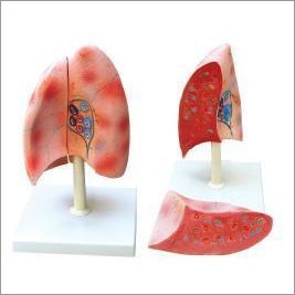 Model Of Human Lungs