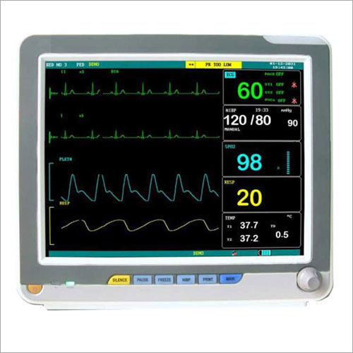 cardiac monitor that contiusly monity st elevation