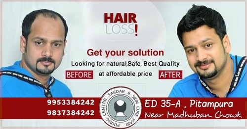 Non Surgical Hair Transplant Solution