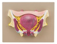 BLADDER PATHOLOGY