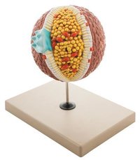 CHOLESTEROL