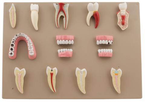 Dental Disease Set of 14