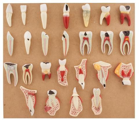 Dental Disease Set of 25