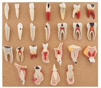 Dental Disease Set of 25