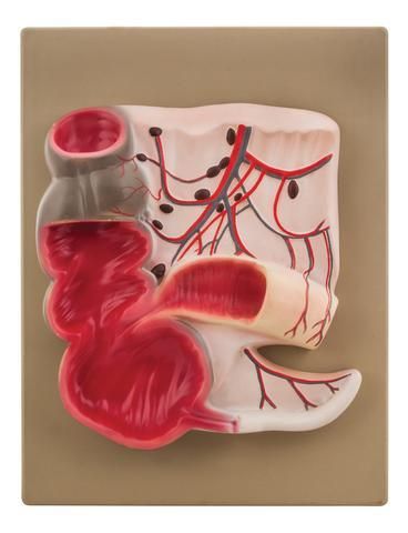 Expansion Model of the Caecum and Vermiform Appendix