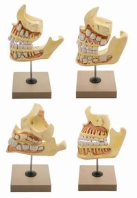 MODEL DENTAL DEVELOPMENT SET - NATURAL SIZE