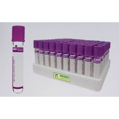 K3 EDTA Tube