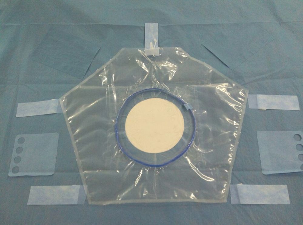 Blue Shi Craniotomy Drape With Pouch