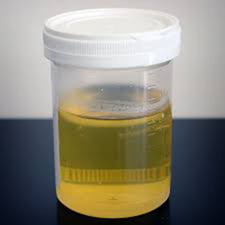 Urine Culture Bottle