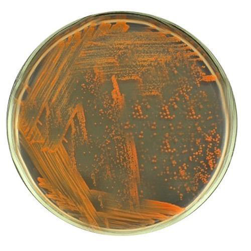 Sulphur Solubilizing Bacteria