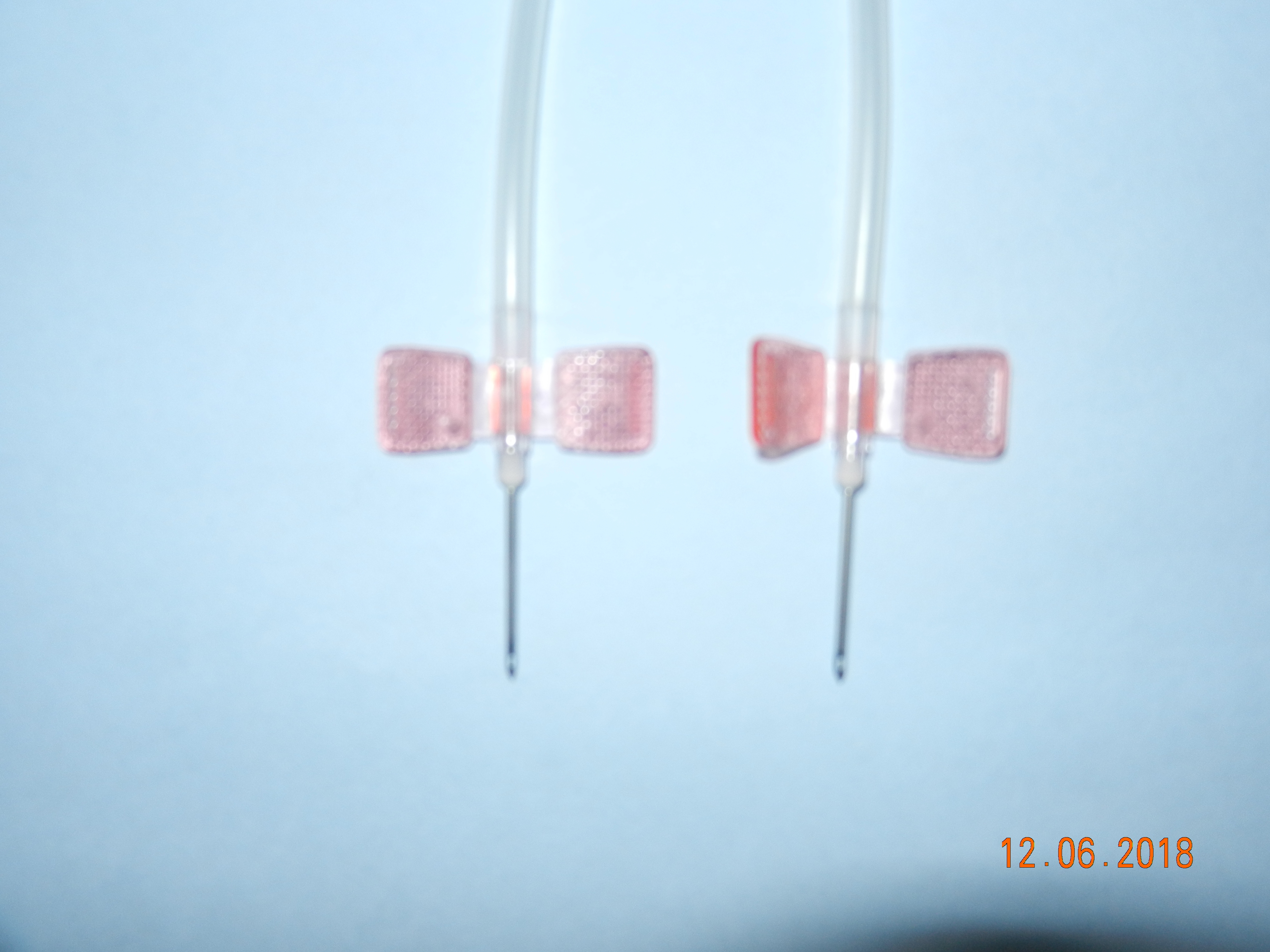 AV Fistula Needle