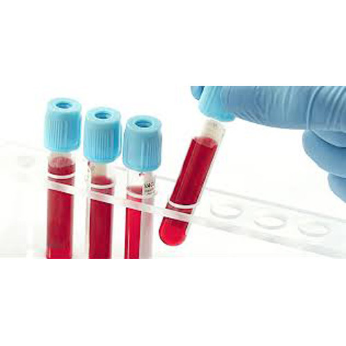Poliovirus Blood Test Tube