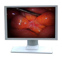 Medical Grade Monitor- 24 Inch