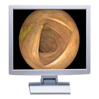 Medical Grade Monitor- 32 Inch - Application: Endoscopy