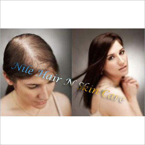 Ladies Hair Replacement Services