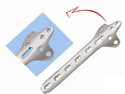 Locking Cloverleaf Plate For 3.5mm Screws