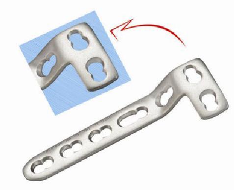 Locking L Buttress Plate For 5.0mm Screws