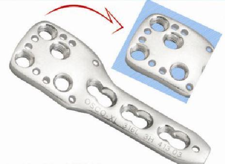 Locking Proximal Humerus Plate For 3.5mm Screws