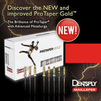 Protaper Gold Files