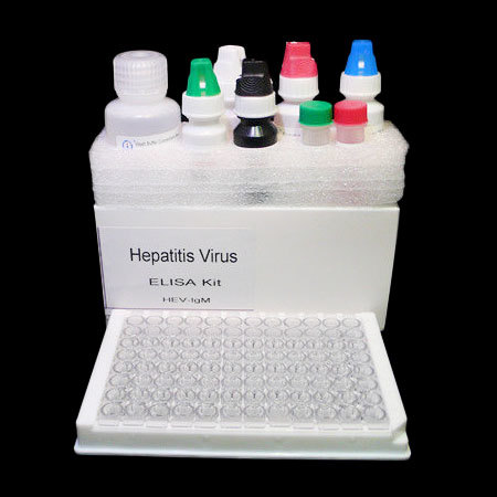 Hepatitis E Virus Elisa Kit