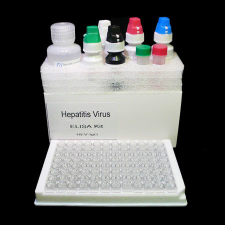 HIV Aids Elisa Test Kit