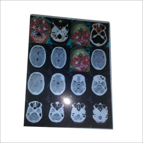 CT Film - Polyester Base High Maximum Density | Lightweight High Sharpness Low Fog Reliable Image Quality