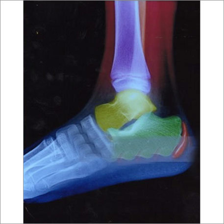 Universal Digital X- Ray Film