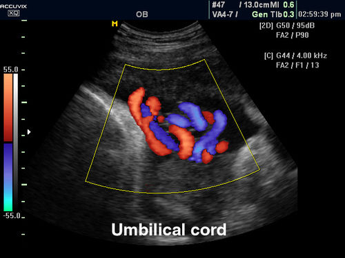 INKJET MEDICAL IMAGING FILM