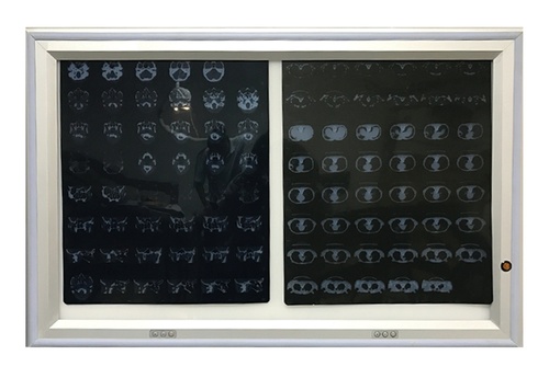 Surgeon Control Panel and LED X-ray Viewer
