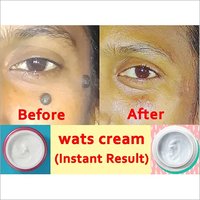 Warts &  Mole Removal Cream General Medicines