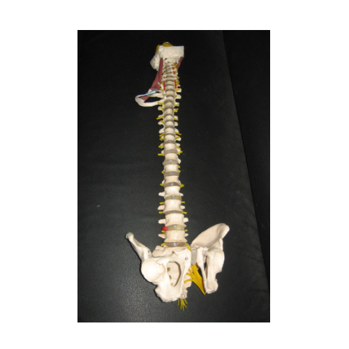 Pathological Spine Model