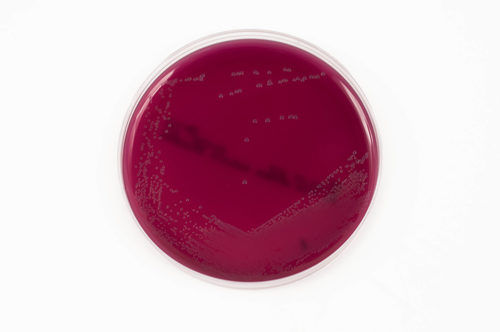 Crystal Violet Agar (Sheep Blood 5%) Application: Na