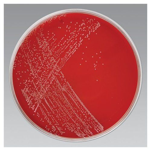 CAMPYLOBACTER AGAR (Sheep Blood 5%)