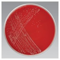 CAMPYLOBACTER AGAR (Sheep Blood 5%)