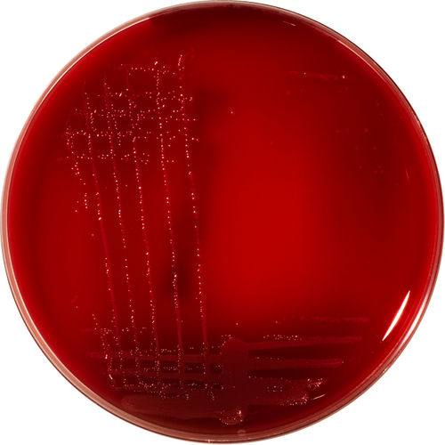 Mueller Hinton Fastidious Agar (Horse blood 5% + 20 mg/L beta-NAD)