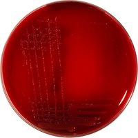 Mueller Hinton Fastidious Agar (Horse blood 5% + 20 mg/L beta-NAD)