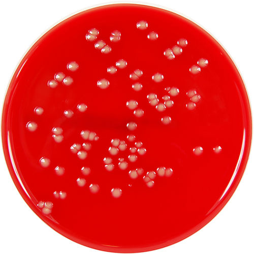 BLOOD AGAR (Sheep Blood 7%)