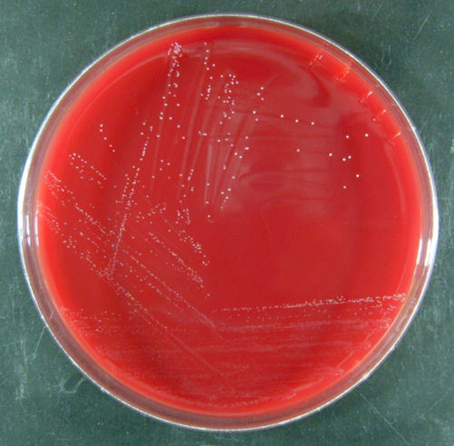 BRUCELLA BLOOD AGAR w HEMIN AND VITAMIN K1